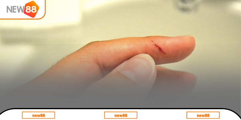 Giải mã hiện tượng nằm mơ thấy đứt tay chảy máu